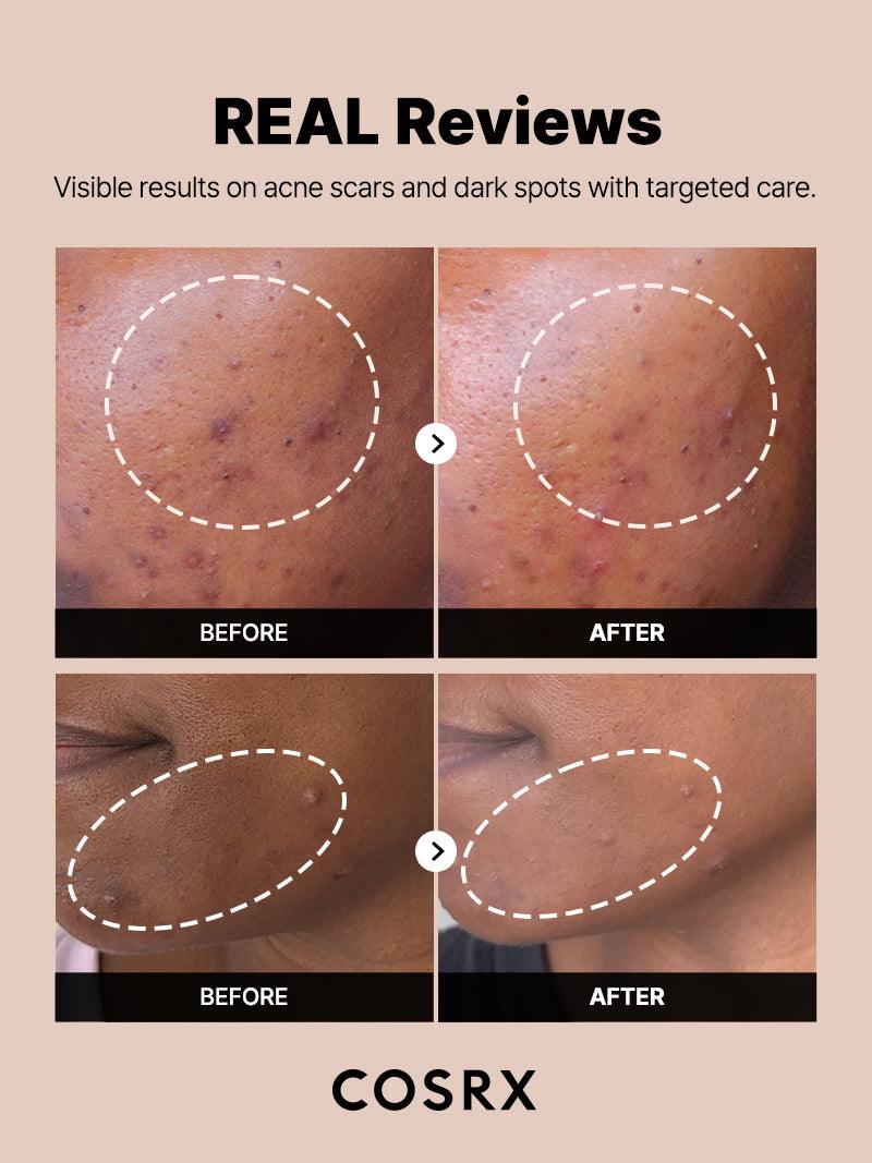 The Alpha-Arbutin 2% Discoloration Care Serum